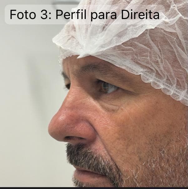 Lateral